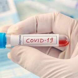 “الأرصاد”: غيوم وفرصة لهطول أمطار رعدية على مرتفعات جازان وعسير والباحة ومكة