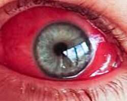 مسلحون يقتحمون موقع تصوير في جنوب افريقيا ويغتصبون 8 نساء