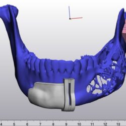 وكيل إمارة الشرقية يفتتح الملتقى الأول للخدمات المقدمة لذوي التوحد على مستوى المنطقة