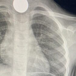 وزير الصحة: نقل الهيئات الصحية الشرعية إلى القضاء العام يعزز حقوق المرضى