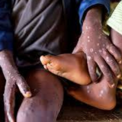 «الأرصاد»: شديد البرودة ورياح مثيرة للأتربة على عدة مناطق