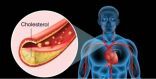أطعمة ترفع نسبة الكوليسترول الضار في الدم وتزيد خطر الإصابة بالسكتة الدماغية والنوبة القلبية