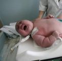 إمراة تلد مولودة تزن ” 7 كيلو جرام “