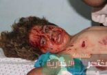 نقابة الأطباء الإسرائيلية : نتنياهو مصاص للدماء